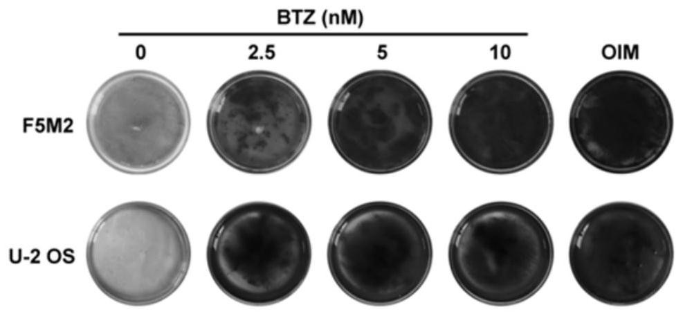 Application of bortezomib in preparation of medicine for treating osteosarcoma