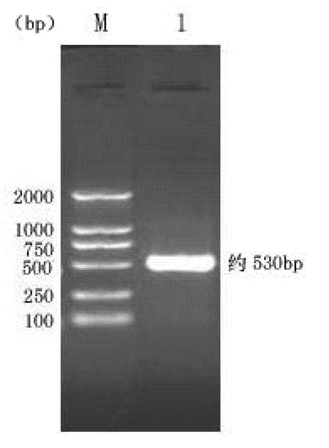 Recombinant porcine epidemic diarrhea virus (PEDV) lactococcus lactis and its construction method and use