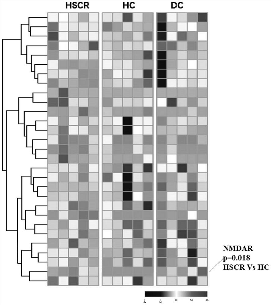 Application of anti-NMDAR autoantibody as congenital megacolon diagnostic marker