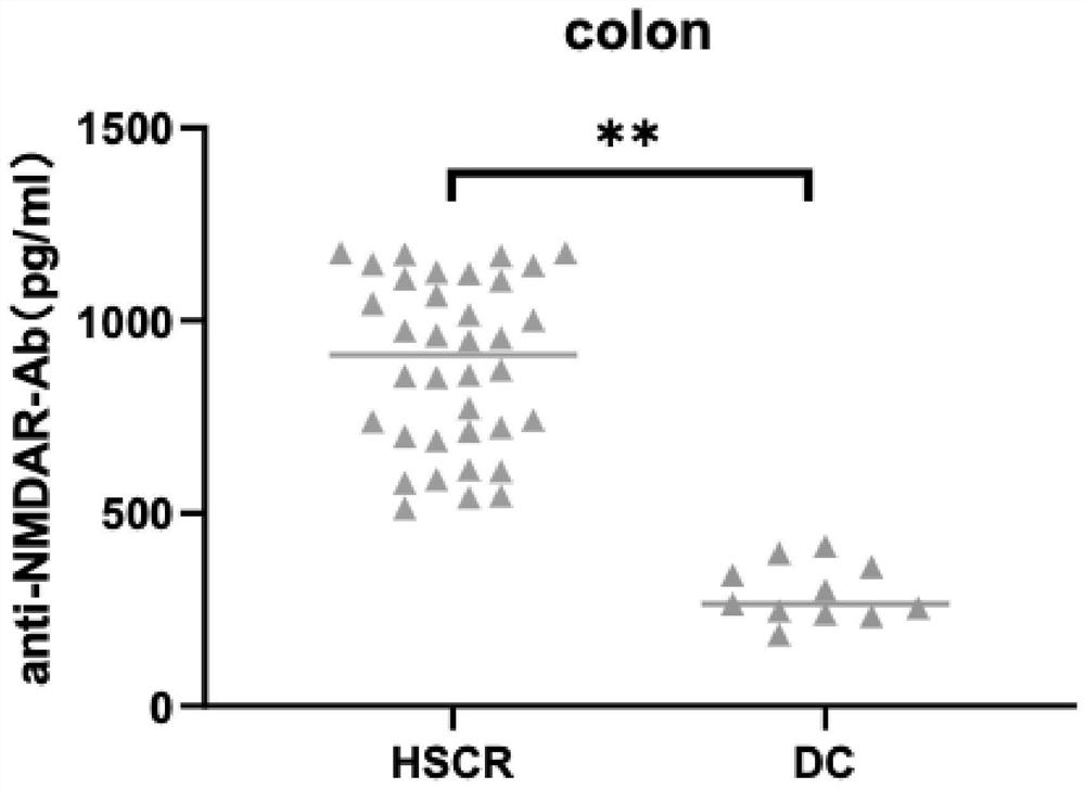 Application of anti-NMDAR autoantibody as congenital megacolon diagnostic marker