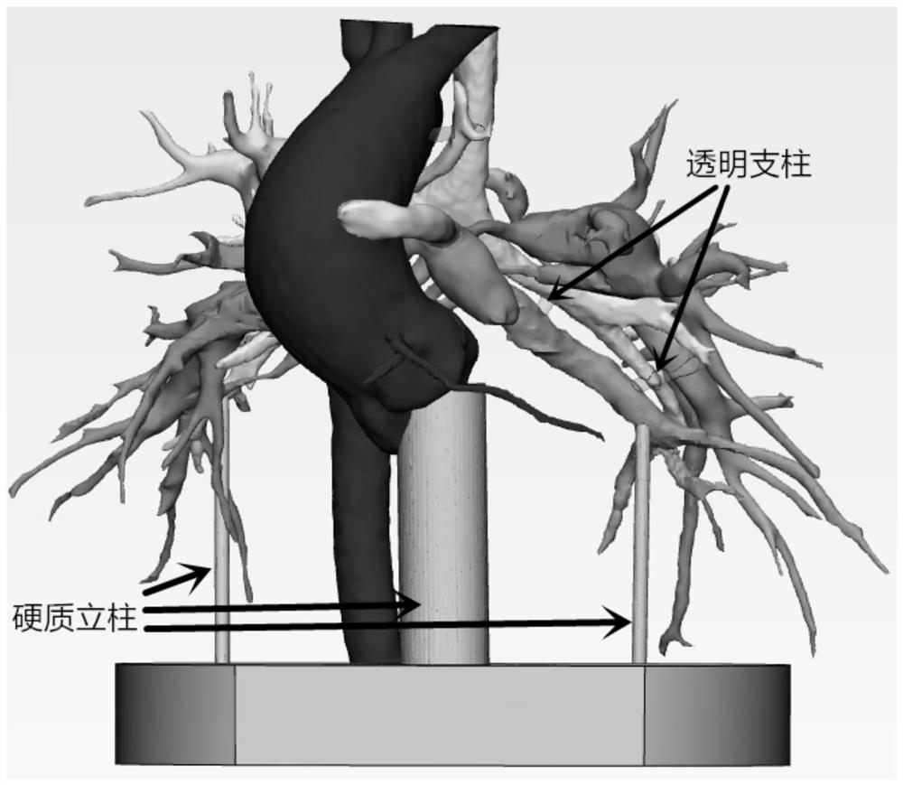 Pulmonary artery atresia combined large main pulmonary collateral vessel model manufacturing method