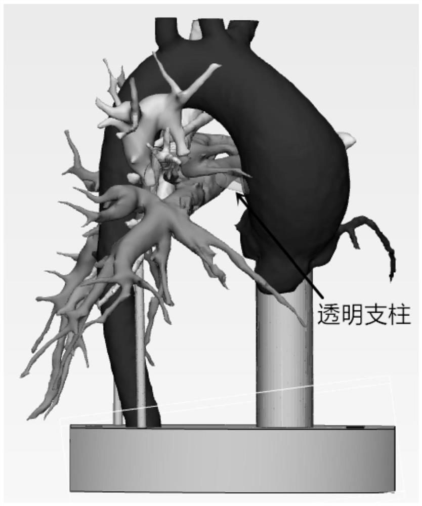 Pulmonary artery atresia combined large main pulmonary collateral vessel model manufacturing method