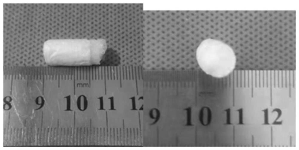 Double-drug-loaded nanofiber hydrogel composite cartilage repair system and preparation method thereof