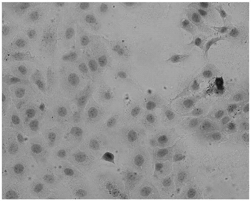 Application of gensenoside C-K to preparing medicines for treating psoriasis