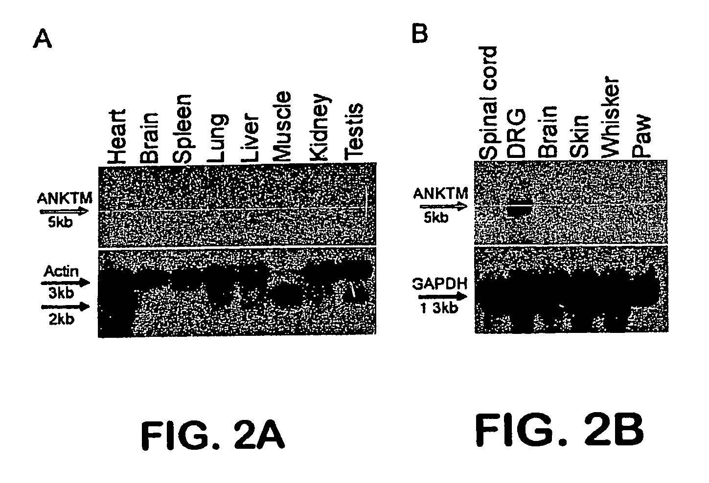 ANKTM1, a cold-activated TRP-like channel expressed in nociceptive neurons