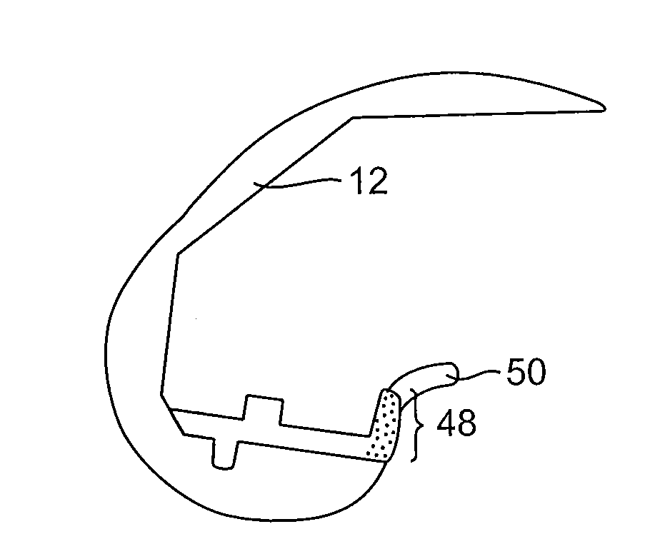 Systems and methods for providing deeper knee flexion capabilities for knee prosthesis patients