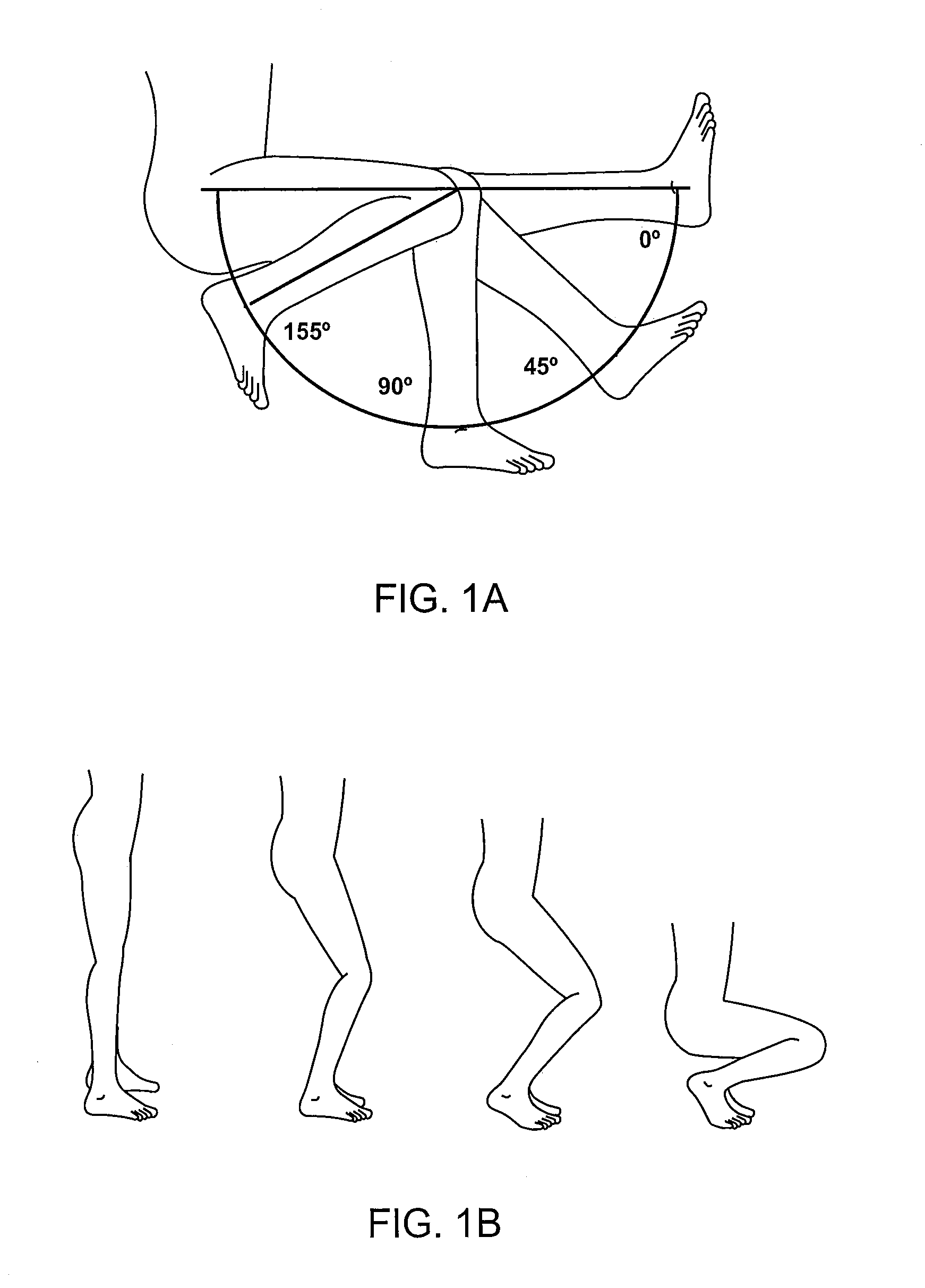 Systems and methods for providing deeper knee flexion capabilities for knee prosthesis patients