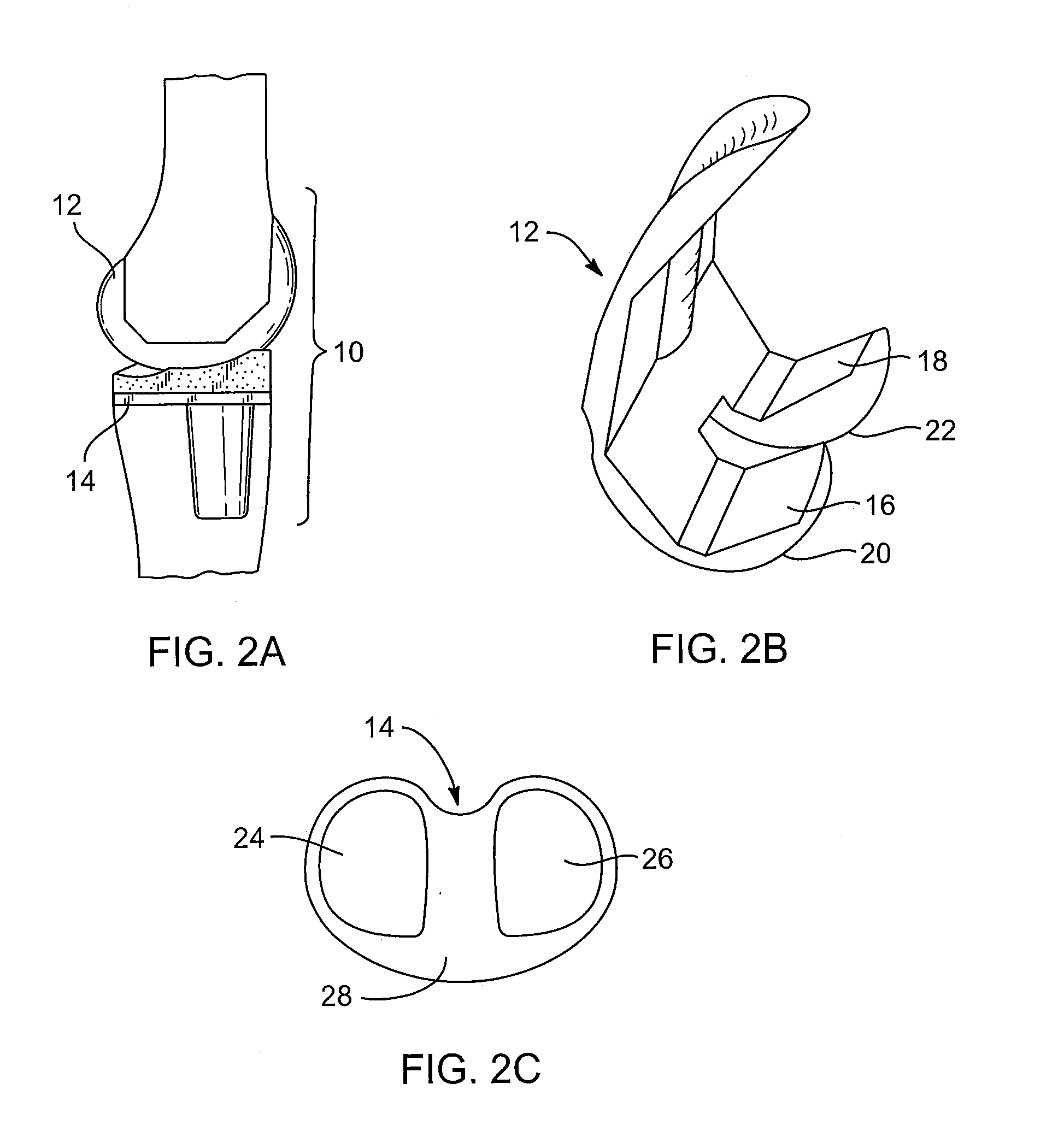 Systems and methods for providing deeper knee flexion capabilities for knee prosthesis patients