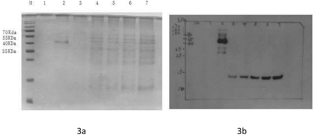 NGF-Fc fusion protein and preparation method thereof