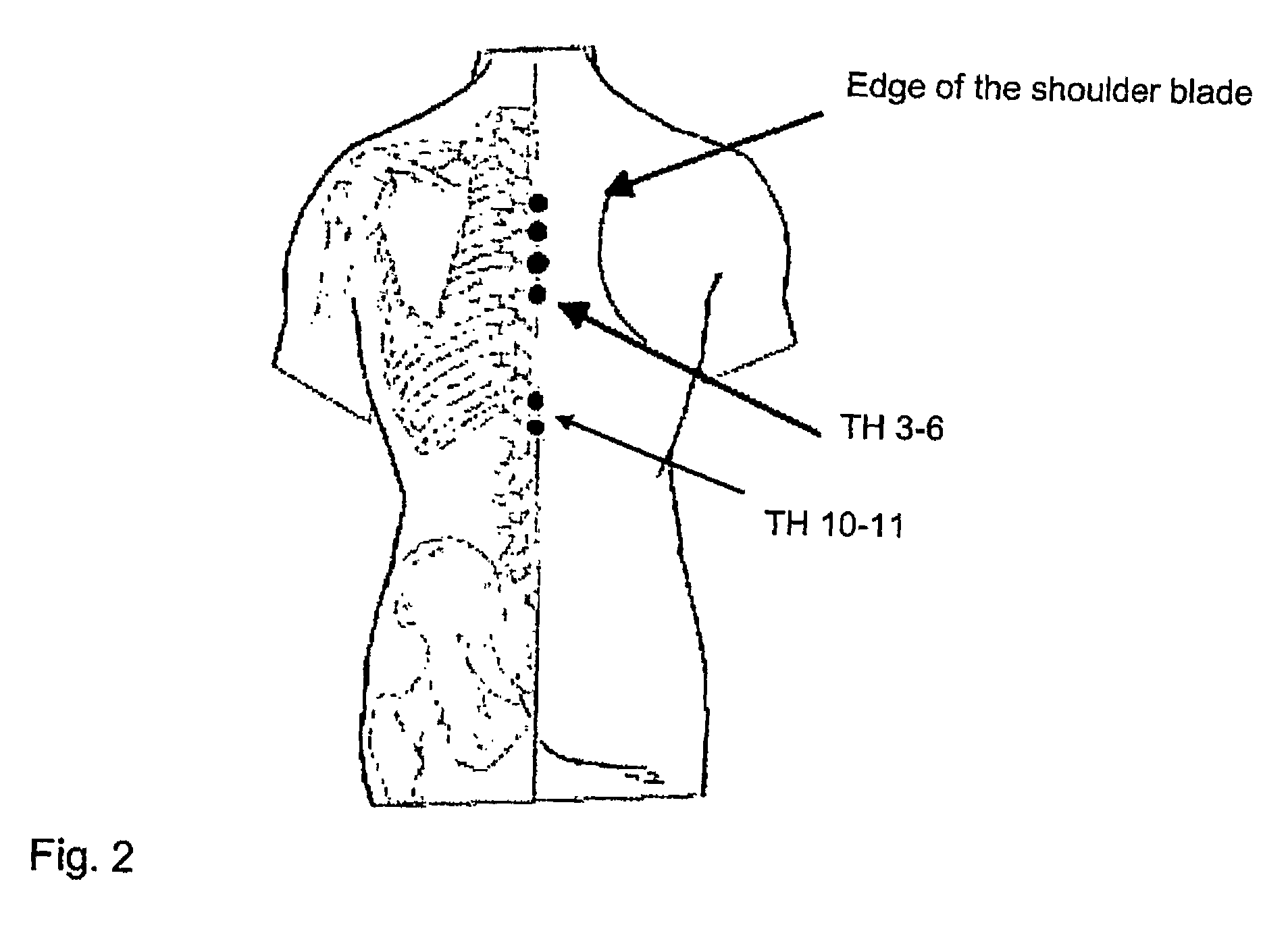 Method of determining the sympathetic tone and system for measurement thereof