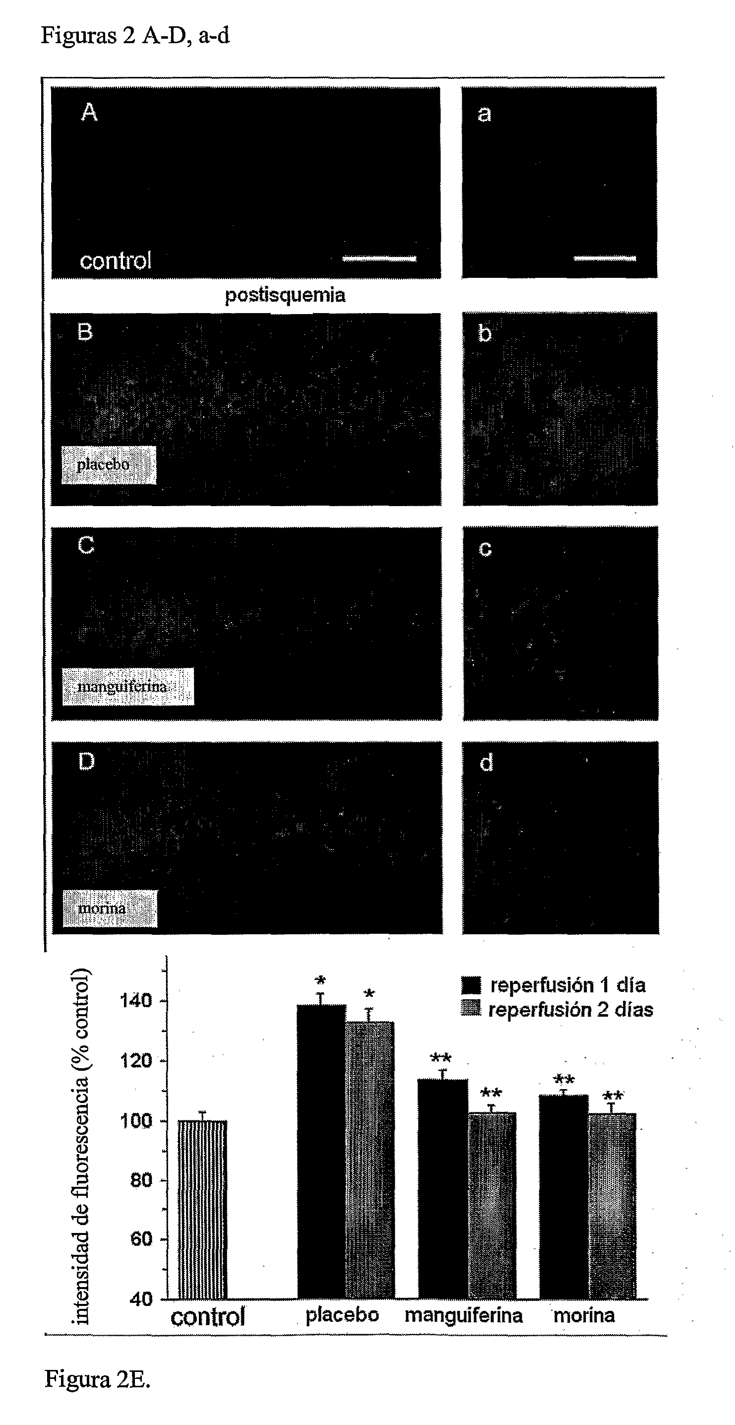 Compounds having neuroprotective properties