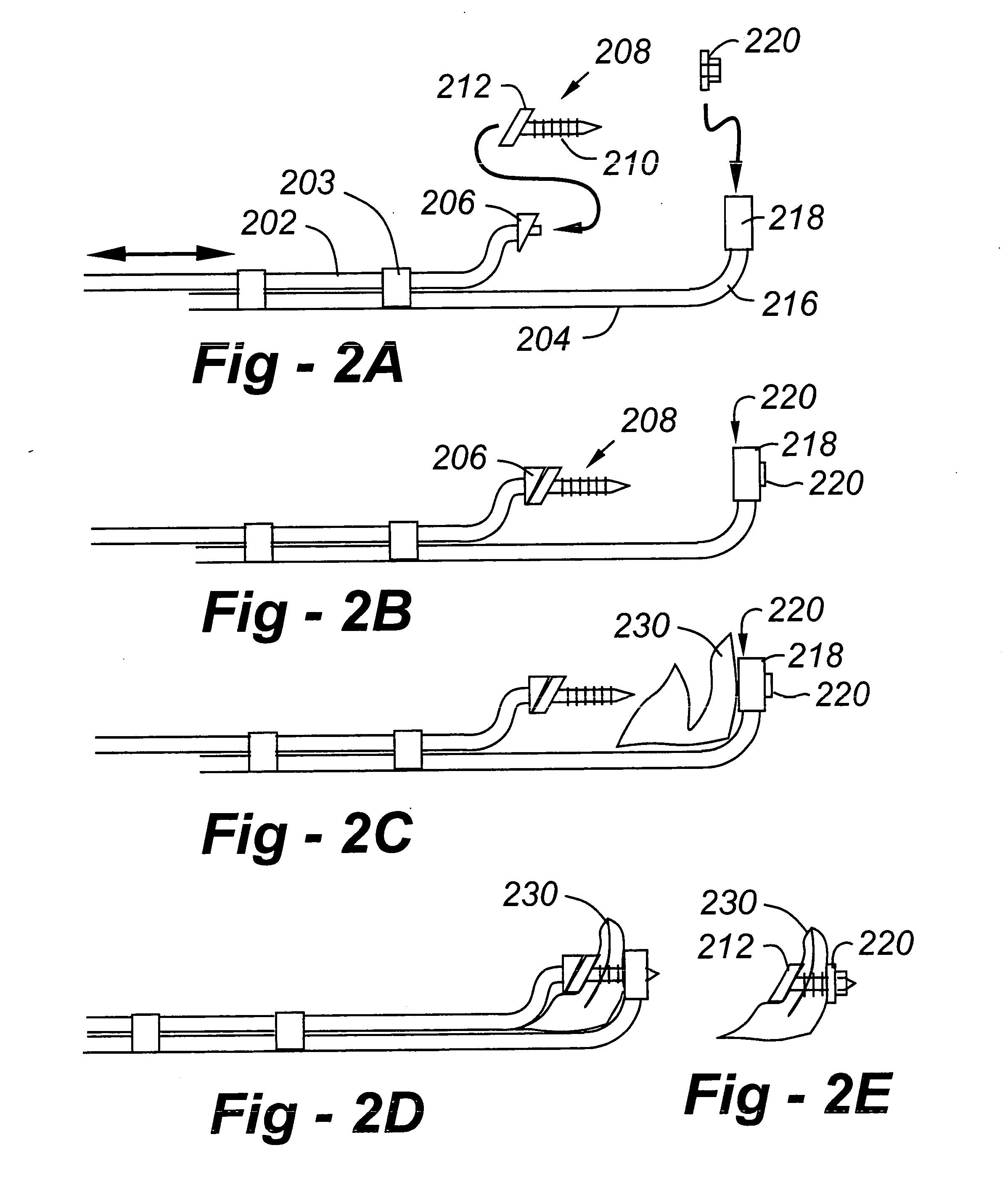 Compression tissue repair apparatus and methods