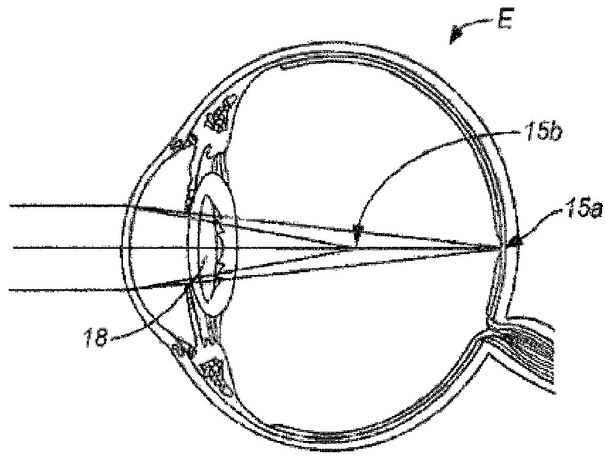 Multi-ring lens, systems and methods for extended depth of focus