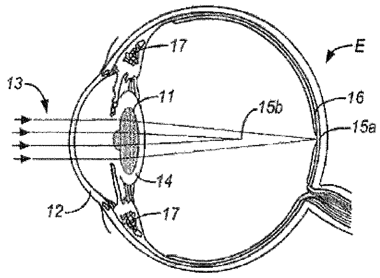 Multi-ring lens, systems and methods for extended depth of focus