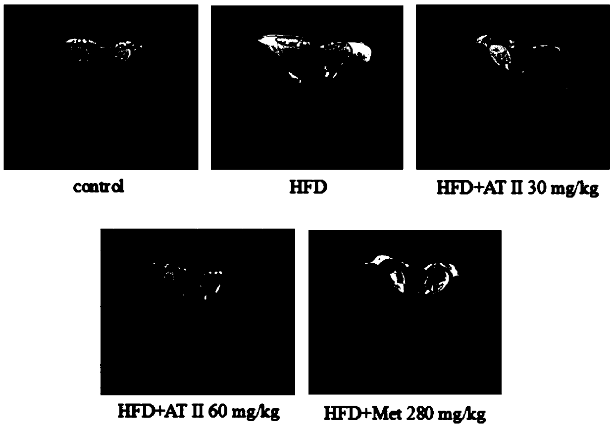 Application of atractylenolide II for preparing medicine capable of improving insulin resistance and glucose-lipid metabolism disorder caused by obesity