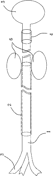 Forked puncture trocar