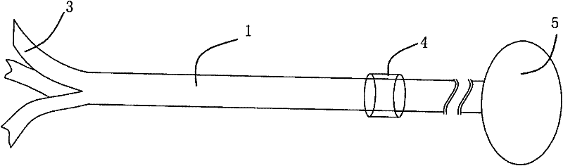 Forked puncture trocar