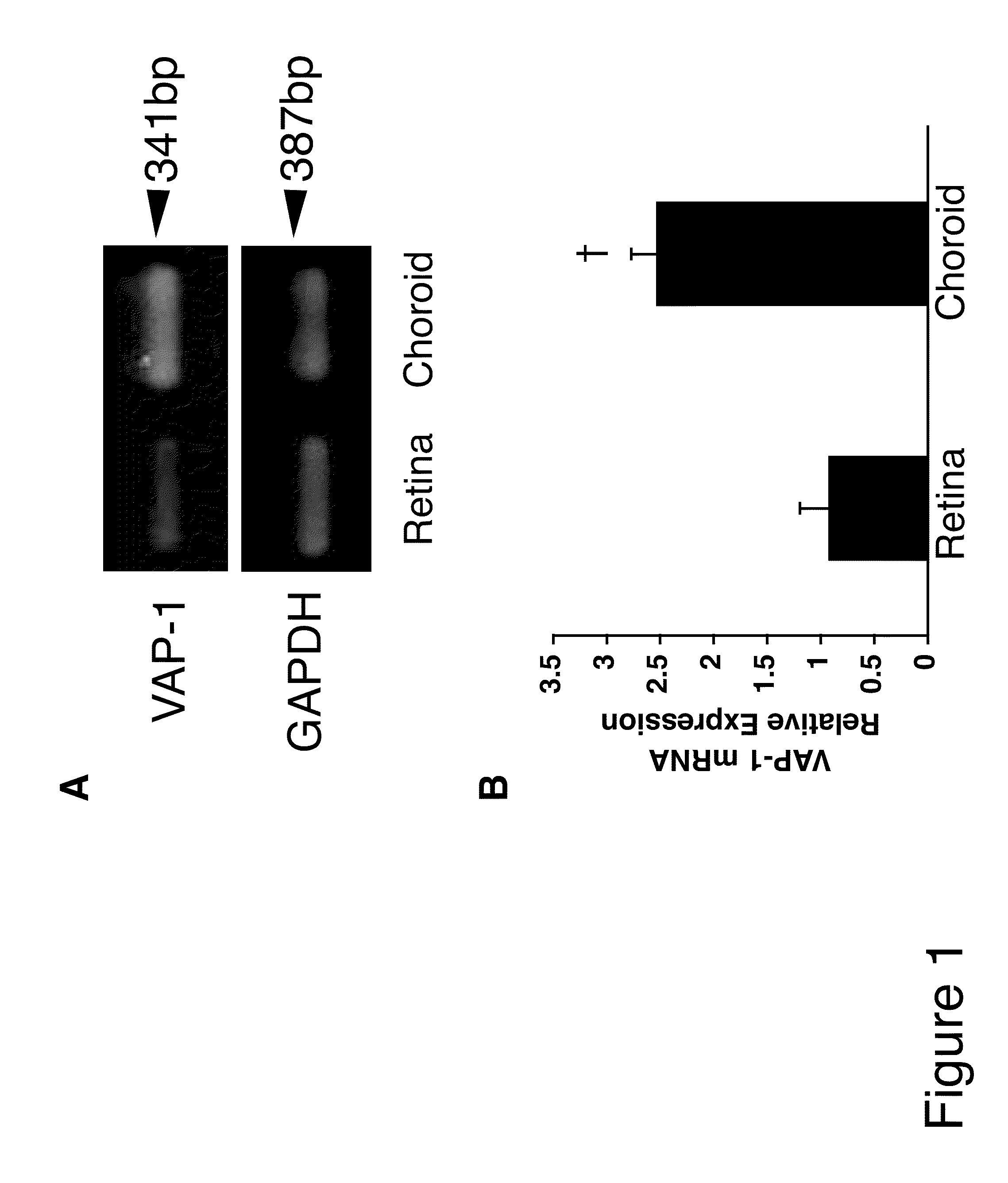 Methods and compositions for treating conditions associated with angiogenesis using a vascular adhesion protein-1 (vap 1) inhibitor