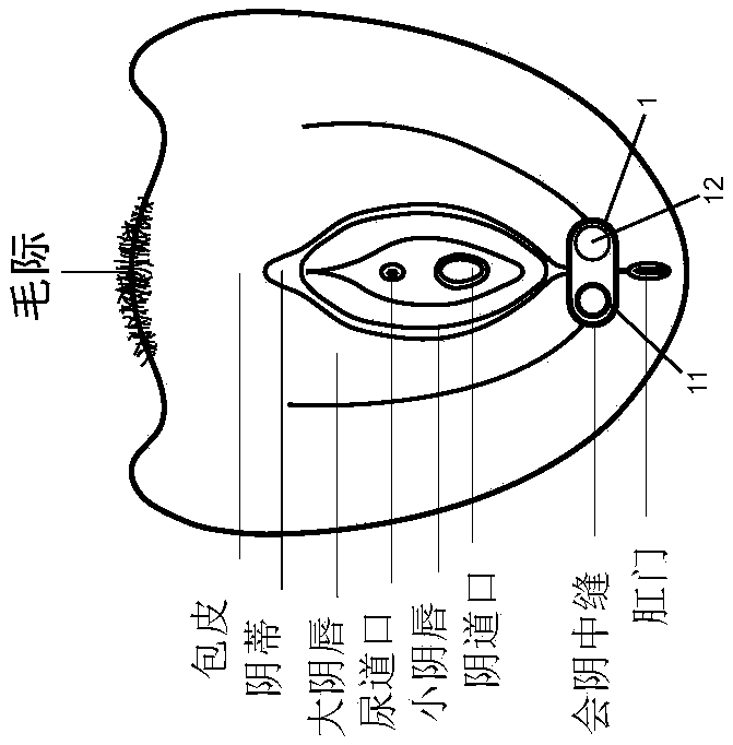 Non-invasive device and method for stimulating vulvar tissues and pelvic floor muscles for treating and improving dysfunction or disorders and probe unit used therefor