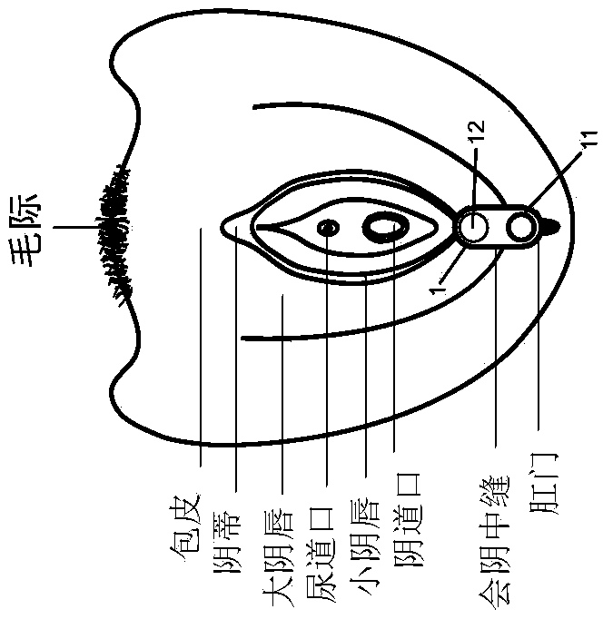 Non-invasive device and method for stimulating vulvar tissues and pelvic floor muscles for treating and improving dysfunction or disorders and probe unit used therefor