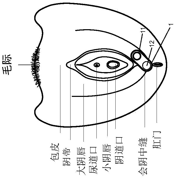 Non-invasive device and method for stimulating vulvar tissues and pelvic floor muscles for treating and improving dysfunction or disorders and probe unit used therefor