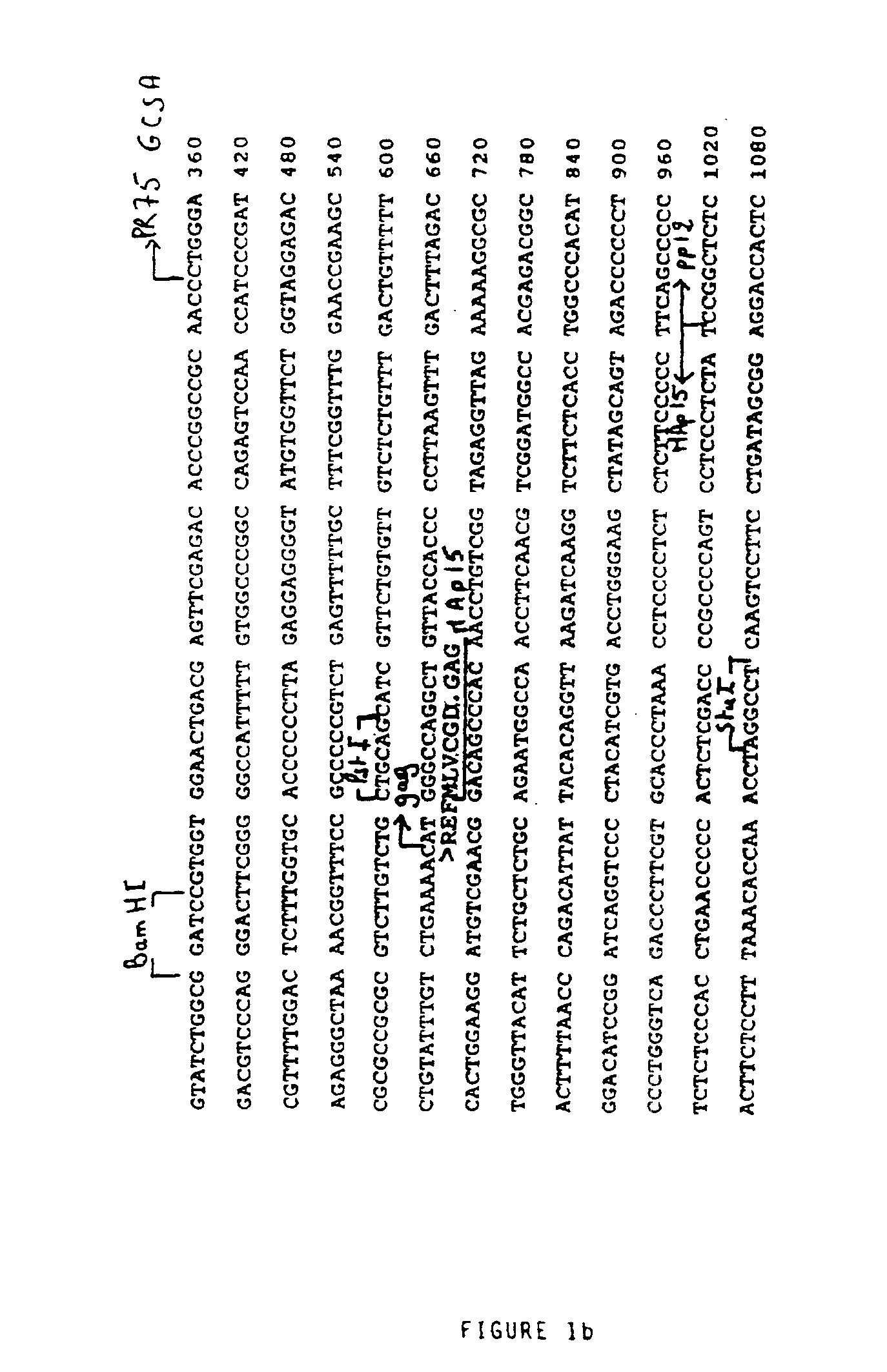 Retroviral vector for the transfer and expression of genes for therapeutic purposes in eukaryotic cells