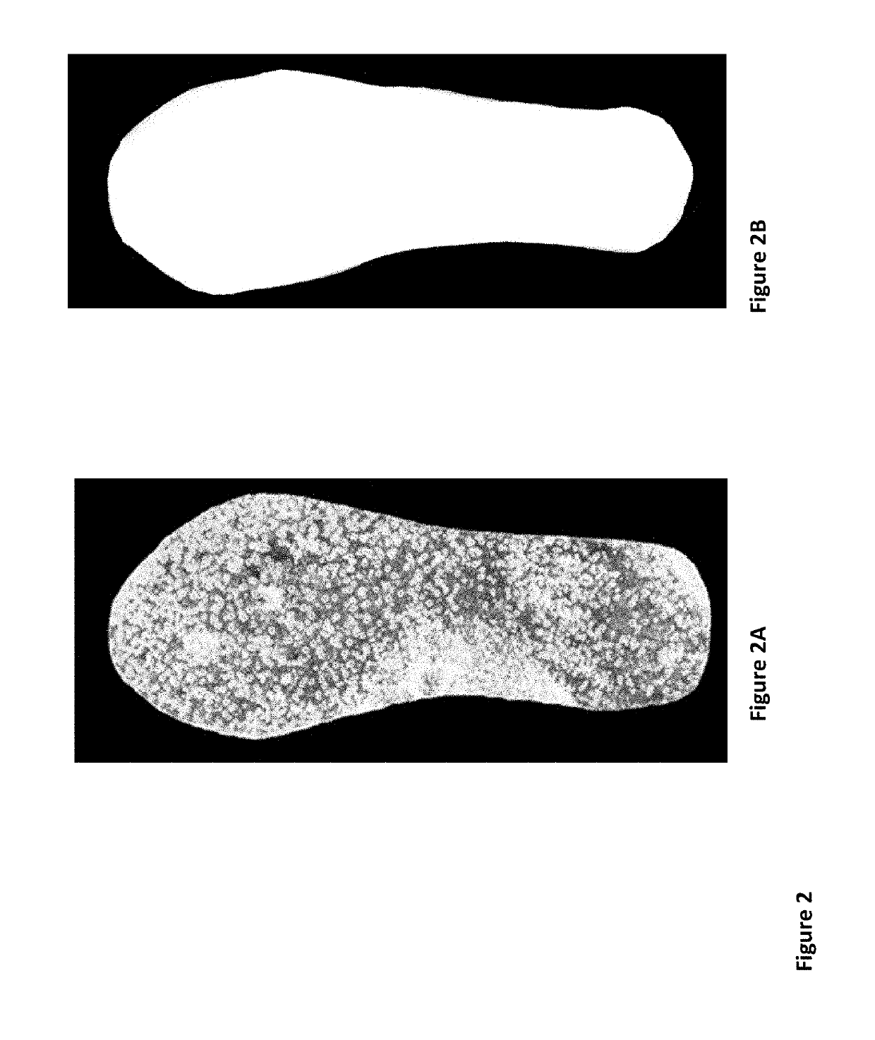 Absorbent polymeric foam for shoe insoles