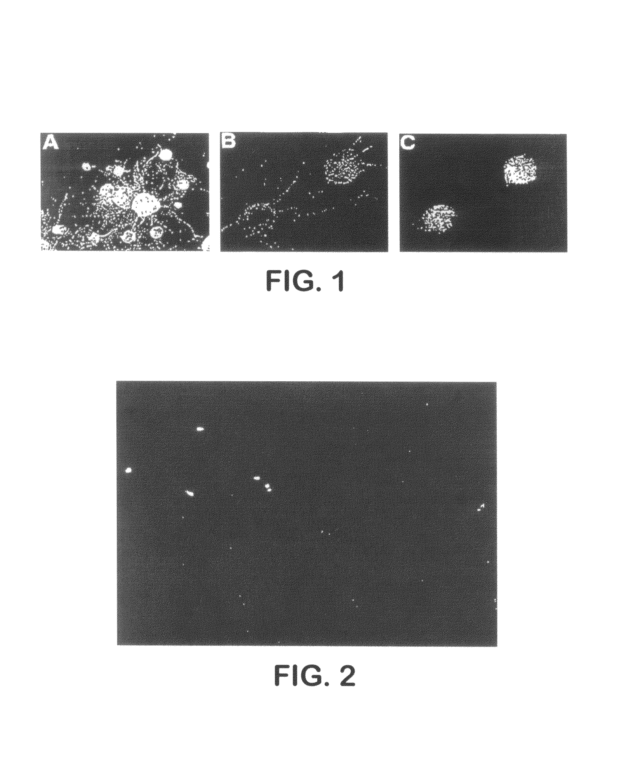 Process of inducing differentiation of embryonic cell to cell expressing neural surface marker using OP9 or PA6 cells