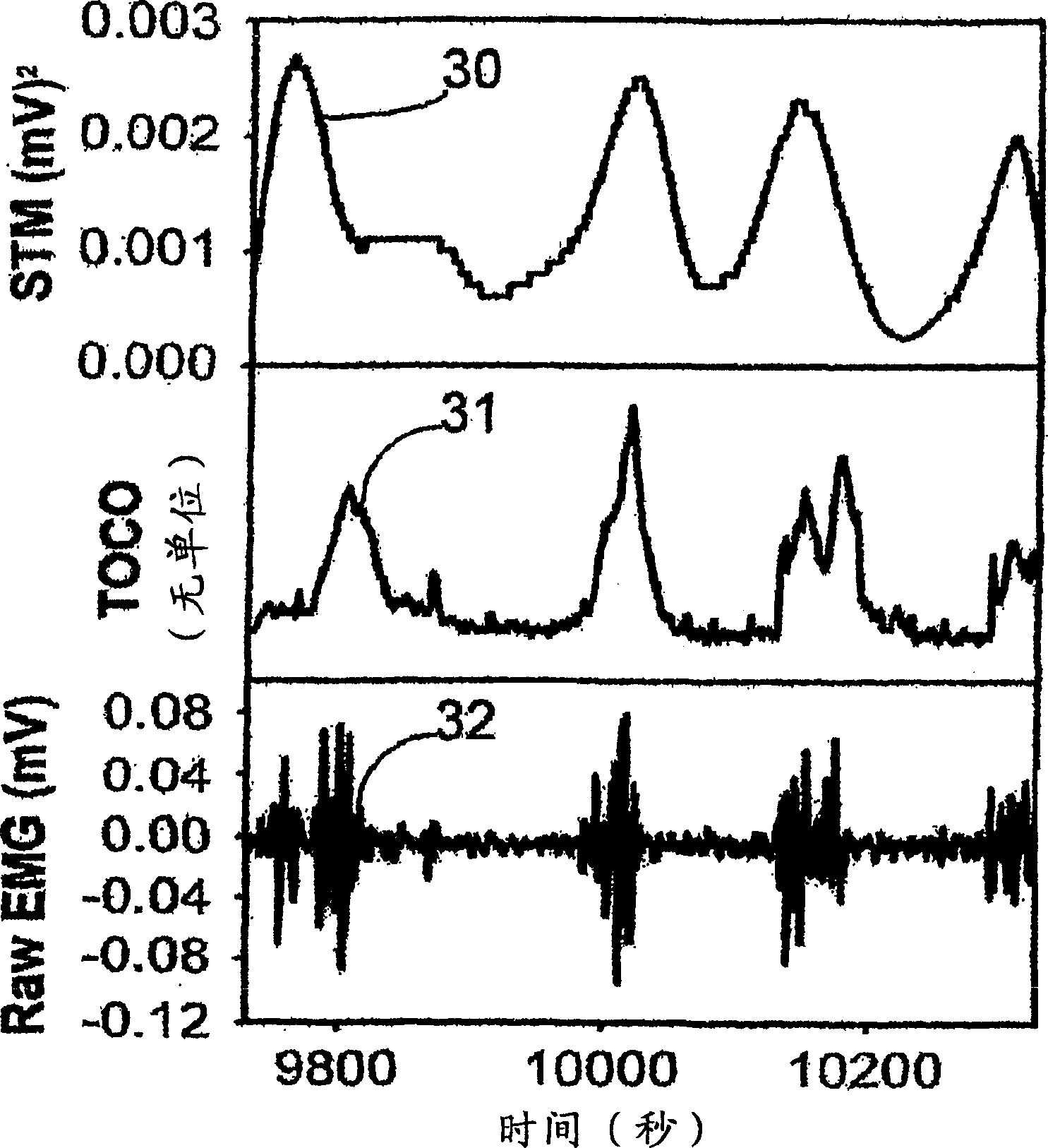 System for detection and analysis of material uterine, material and fetal cardiac and fetal brain activity