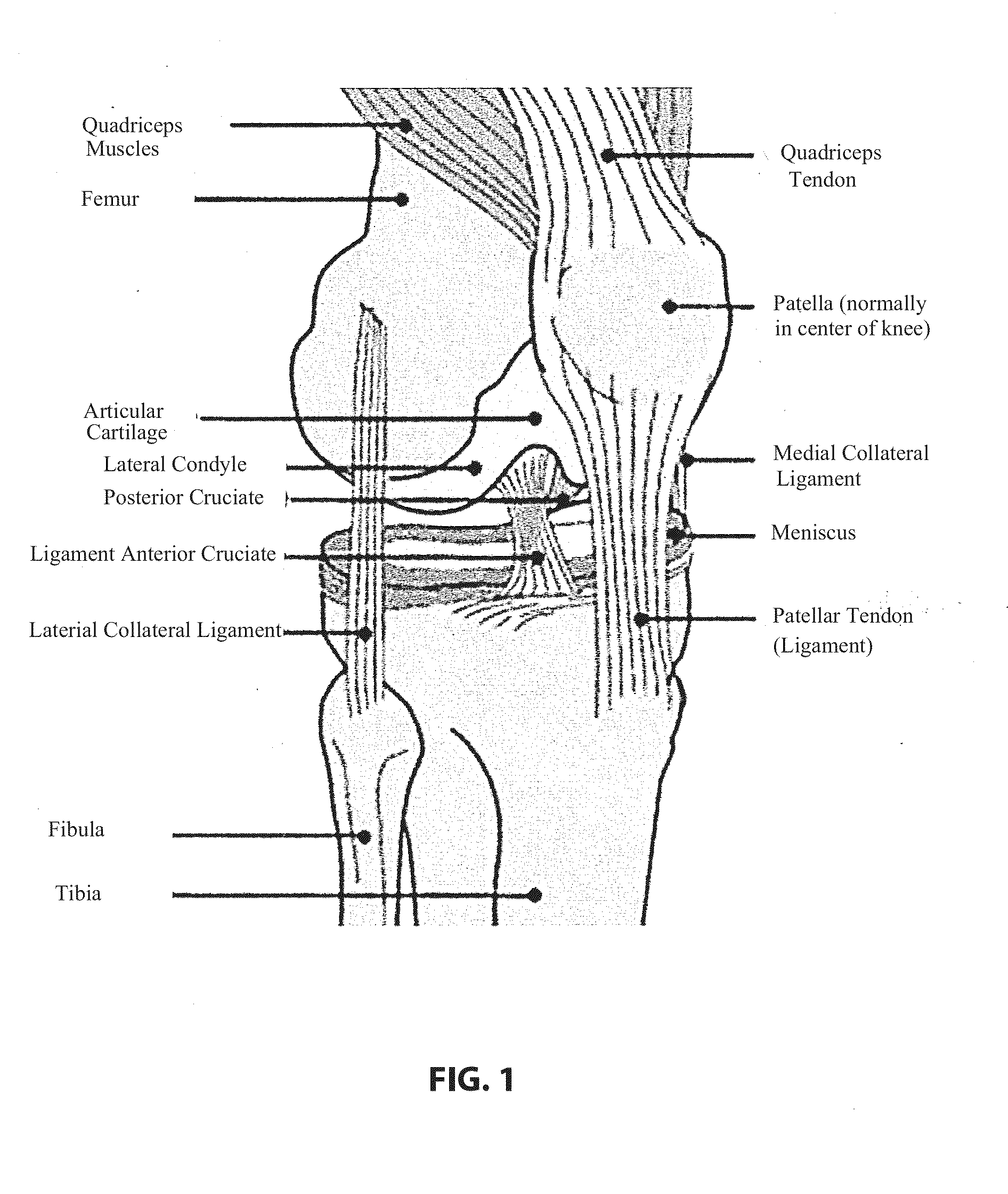 Porated cartilage products