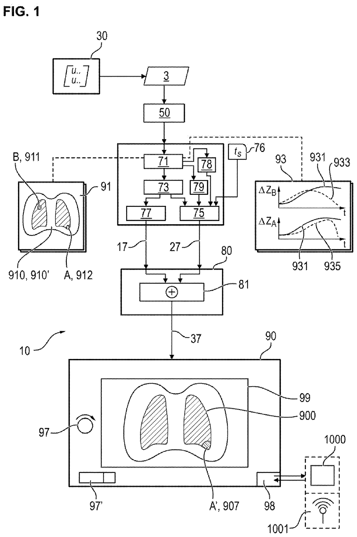 Device for processing and visualizing data of an electric impedance tomography apparatus for determining and visualizing regional ventilation delays in the lungs