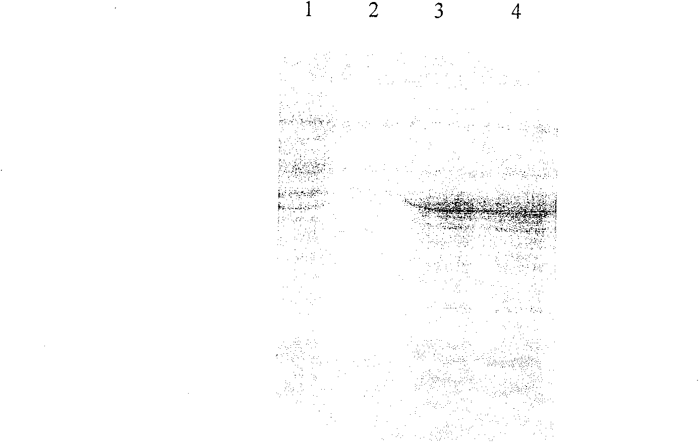 Recombinant expression of human desmocyte growth factor-21