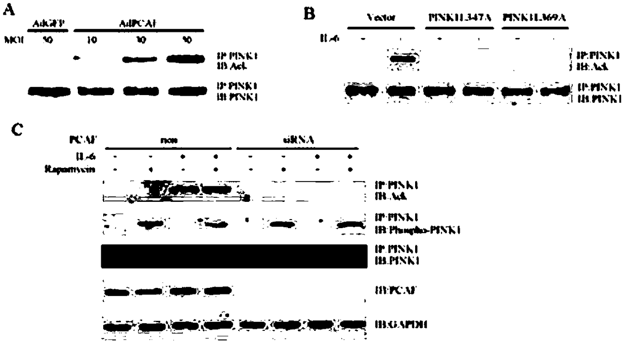 Method for detecting acetylated PINK1 in vascular endothelial cell