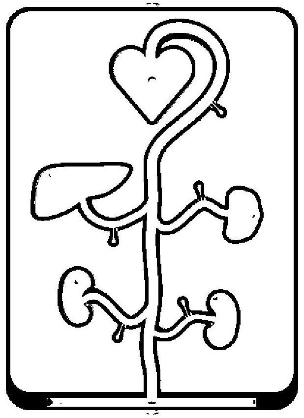 Visceral aneurysm interventional operation model based on 3D printing and manufacturing method