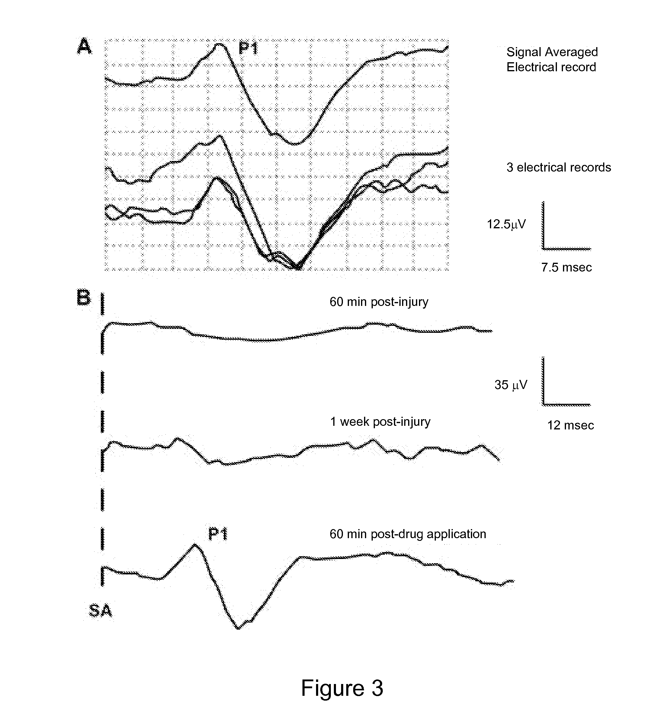 Pyridines for treating injured mammalian nerve tissue