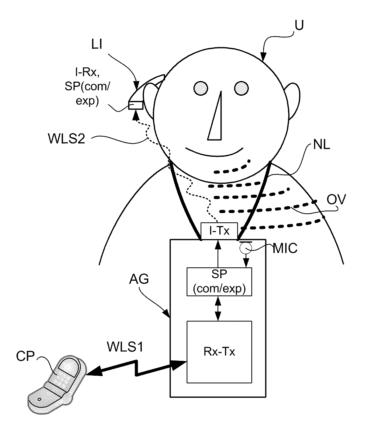 Sound perception using frequency transposition by moving the envelope