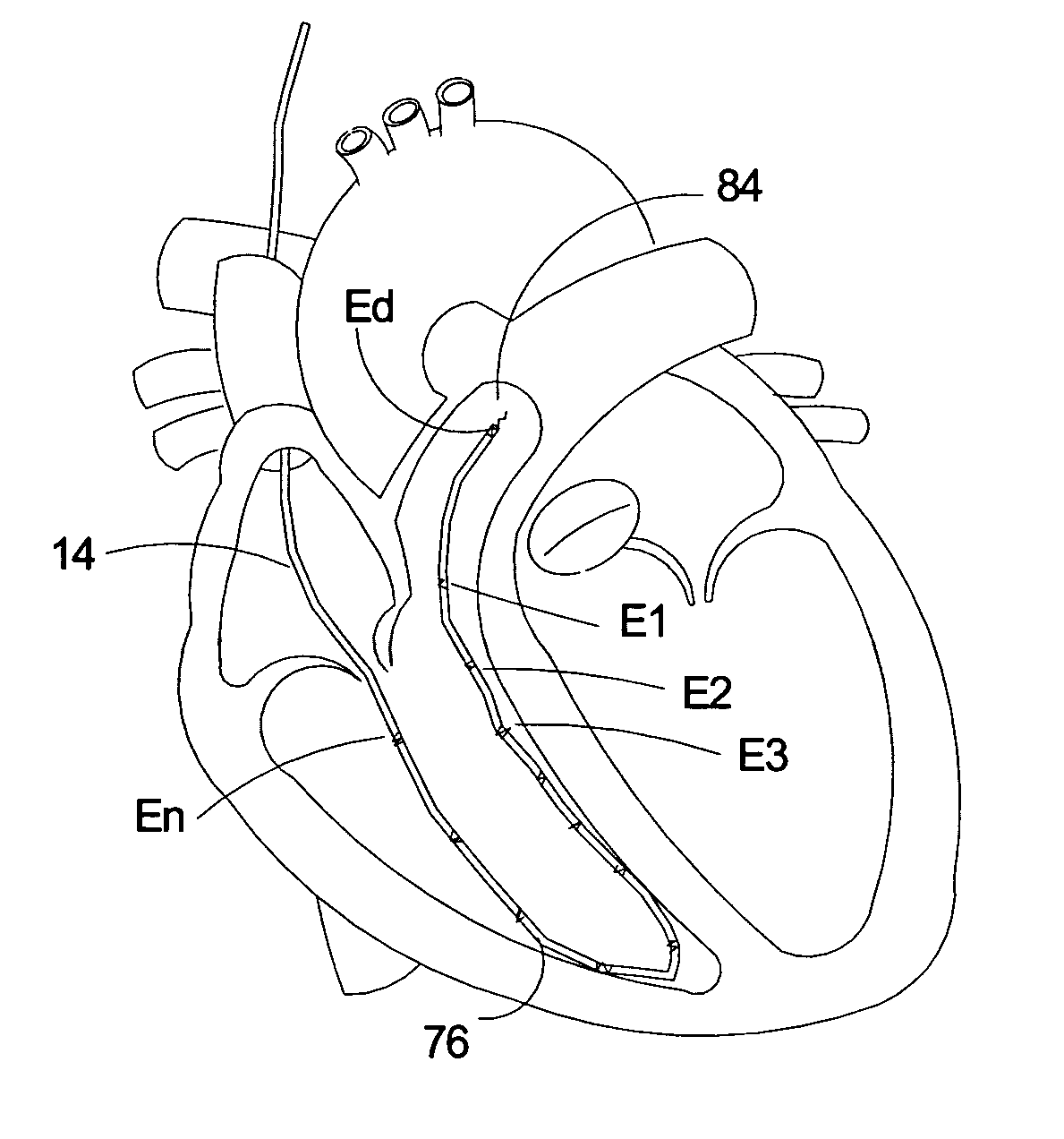 Method for multiple site, right ventricular pacing with improved left ventricular function