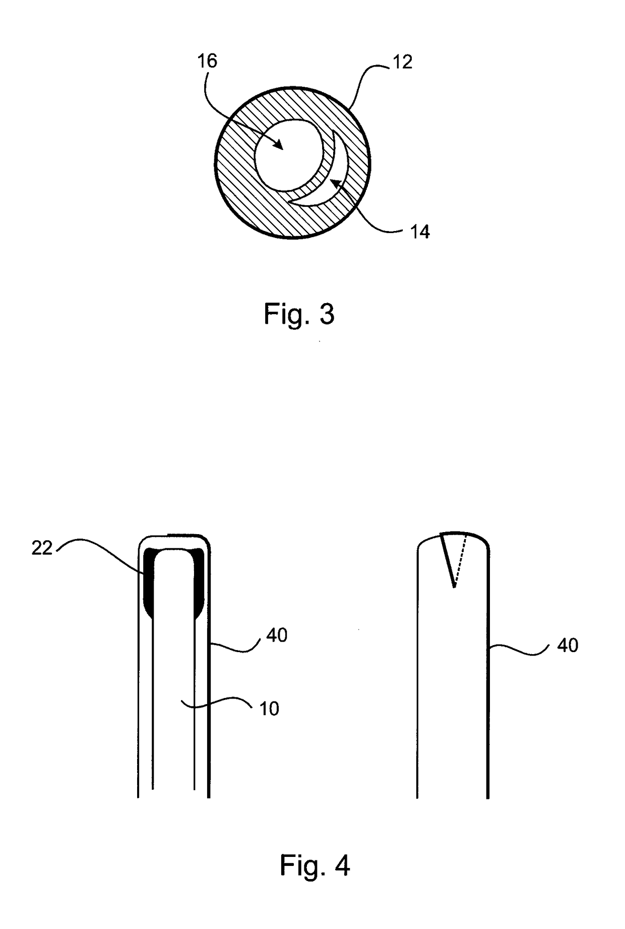 Therapeutic substance transfer catheter and method