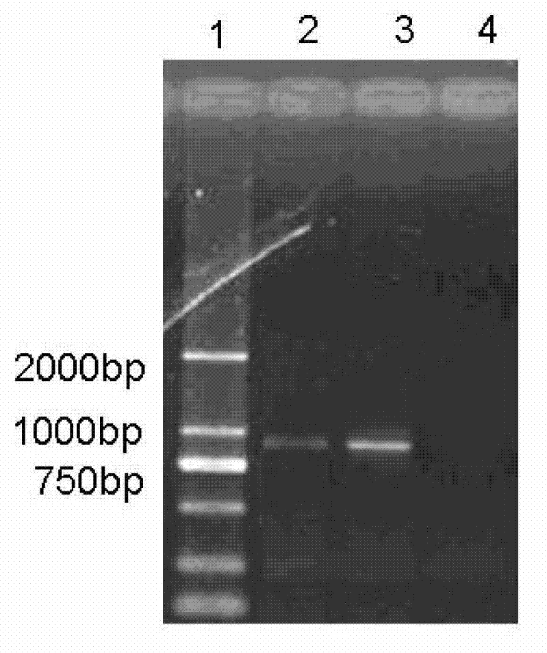 Vaccine composition for preventing and treating porcine circovirus type 2, Haemophilus parasuis and Mycoplasma hyopneumoniae infection and preparation method thereof