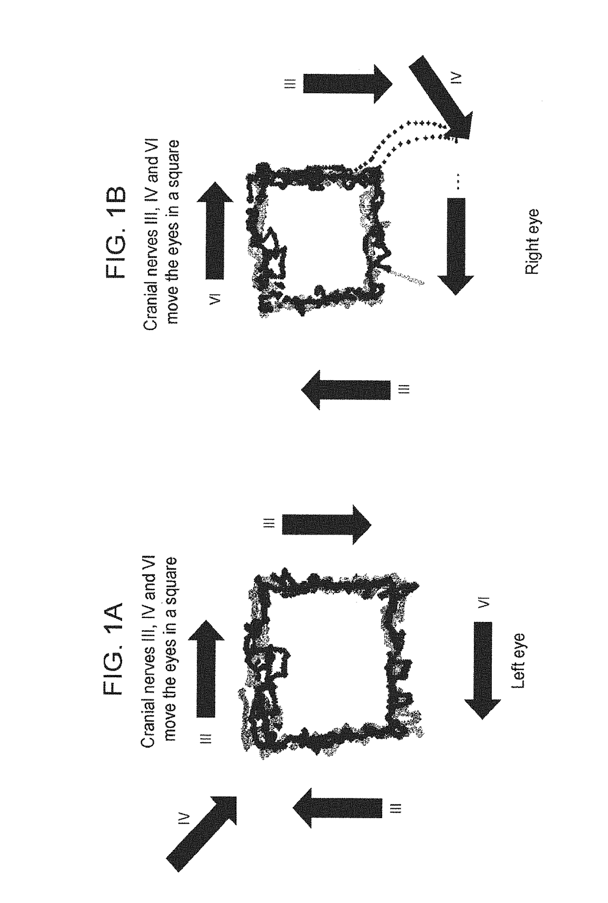 Methods and kits for assessing neurological and ophthalmic function and localizing neurological lesions