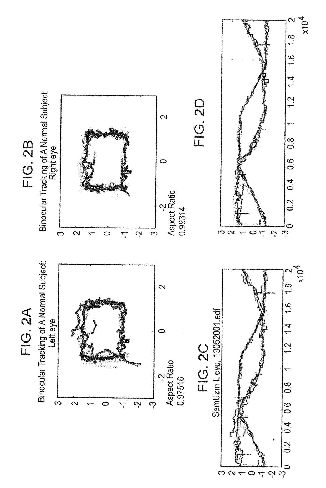 Methods and kits for assessing neurological and ophthalmic function and localizing neurological lesions