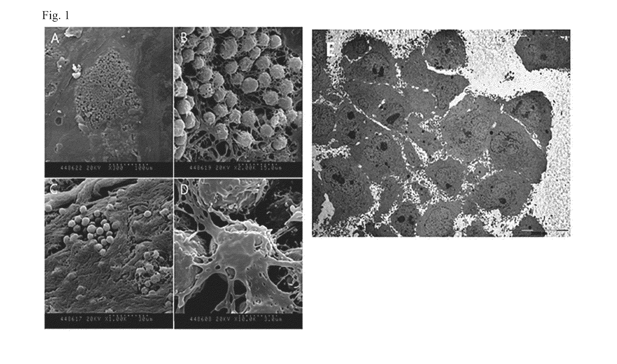 Composition for aggregating biological sample