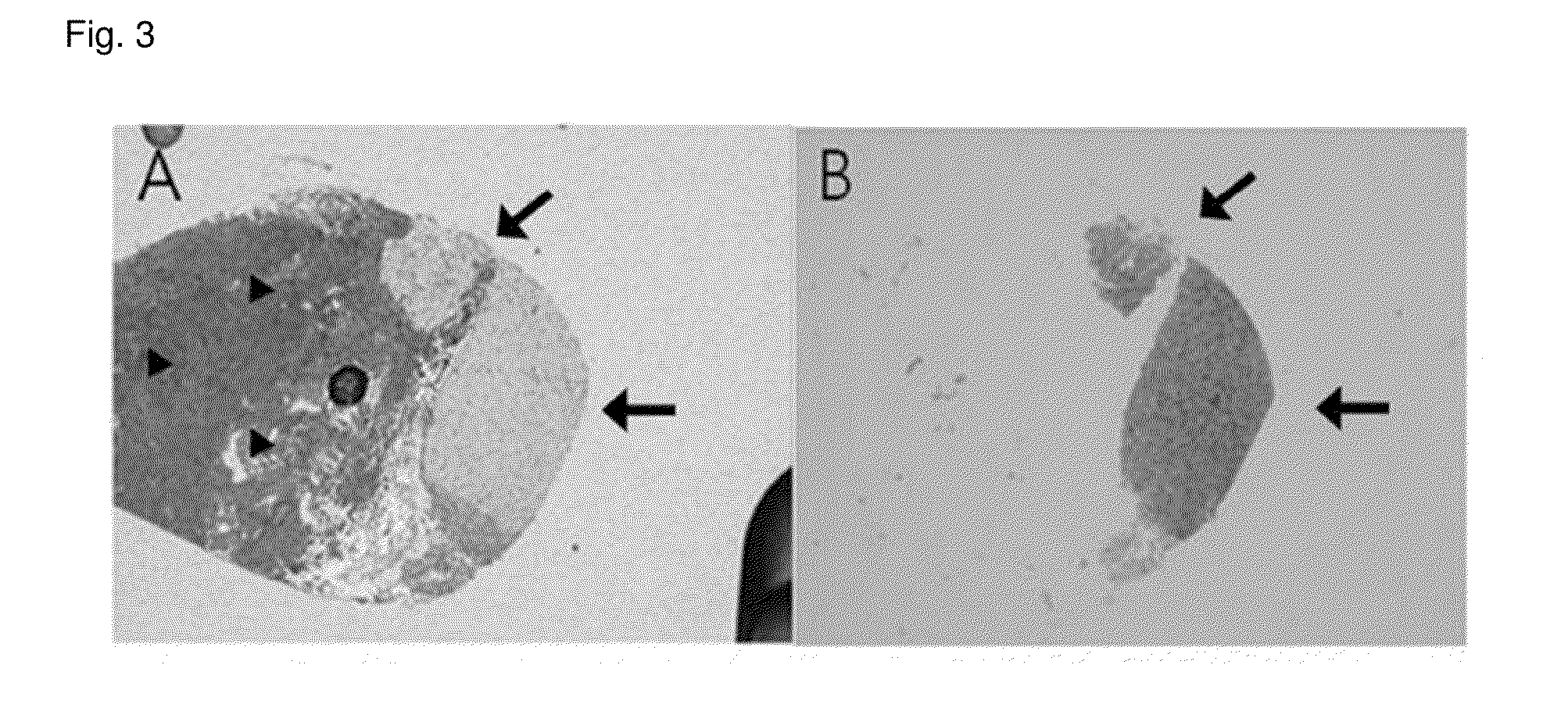 Composition for aggregating biological sample