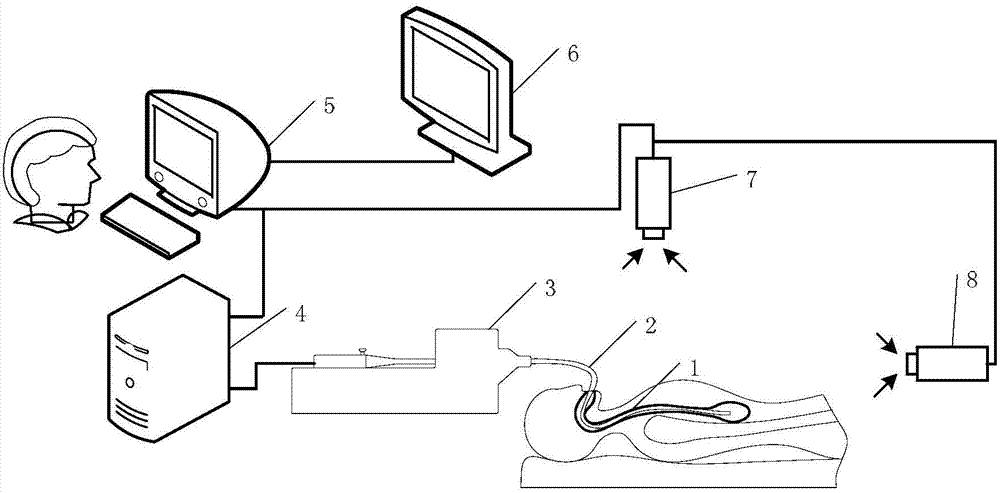 Active snakelike endoscope robot system