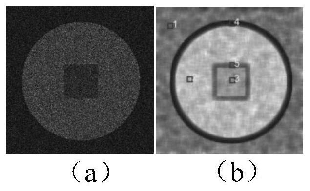 Image speckle suppression method based on region and pixel coupling similarity measurement