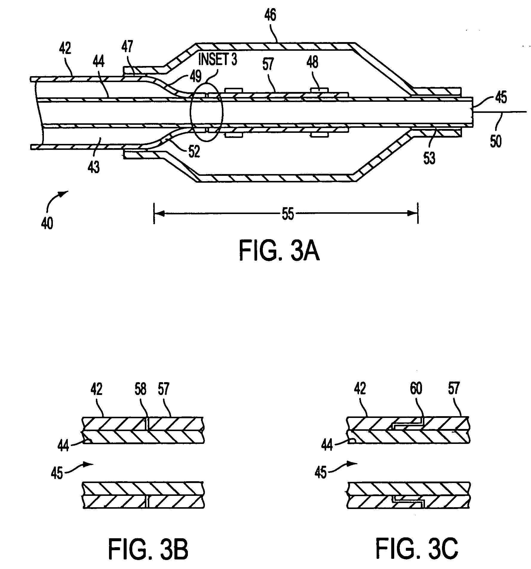 Catheter having enhanced distal pushability