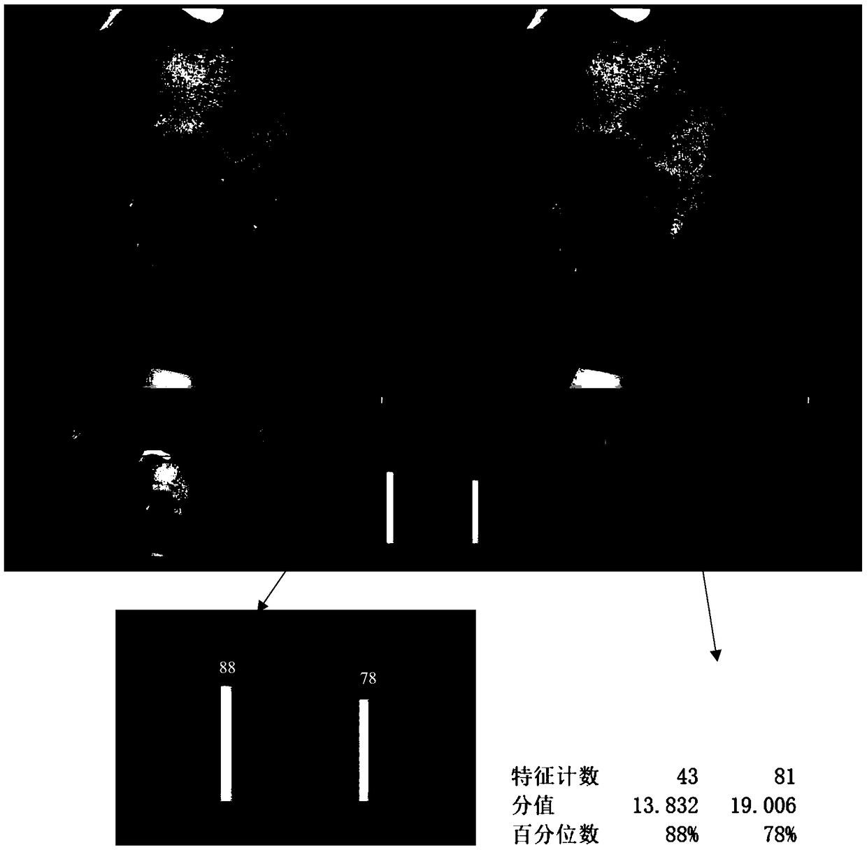 Preparation method of polypeptide wrinkle-removal repair essence