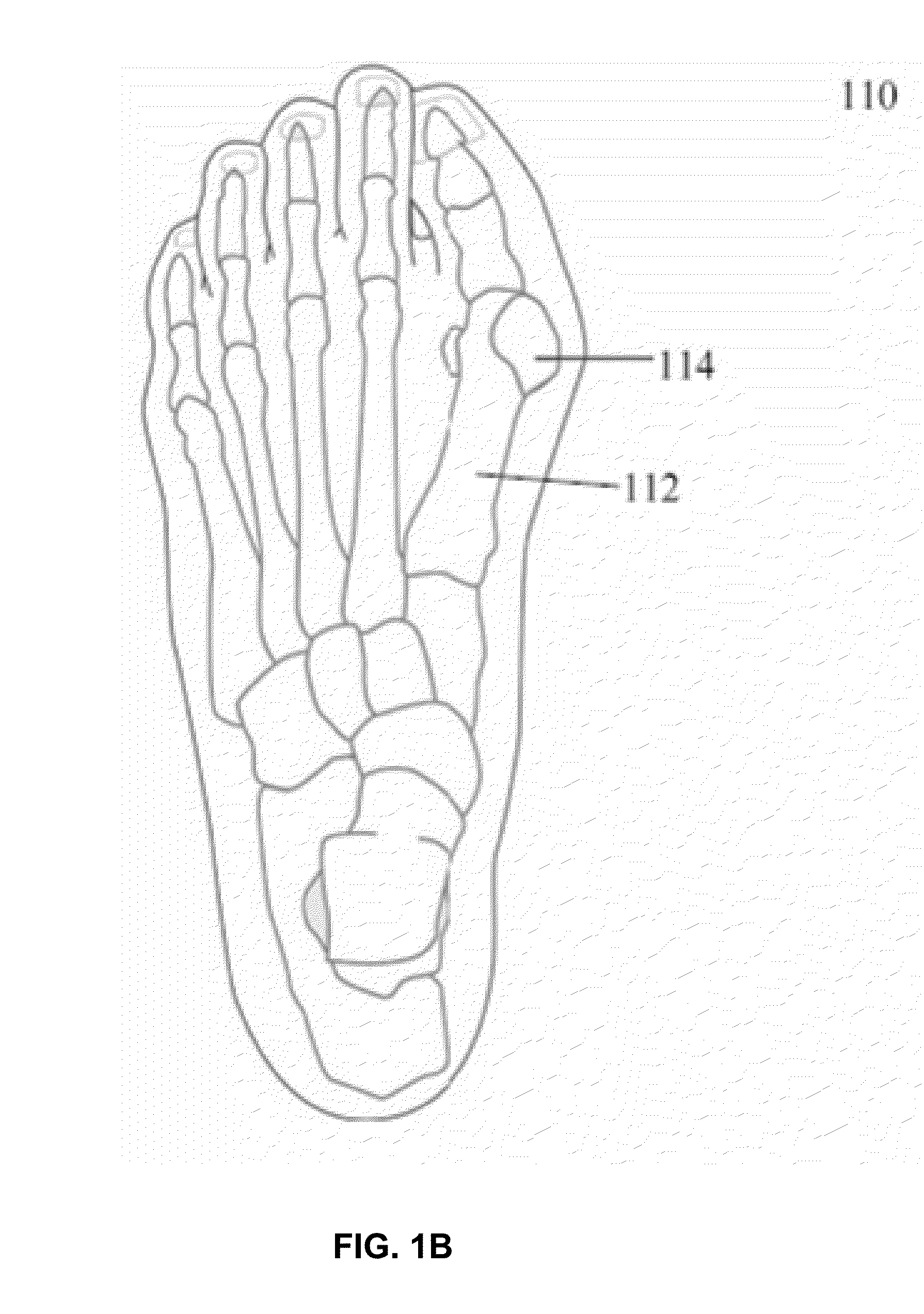 Bone fixation device and method