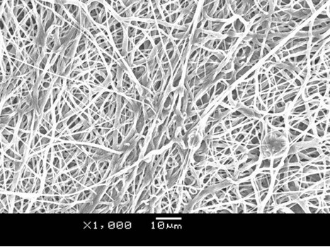 Biodegradable extravascular stent and preparation method thereof