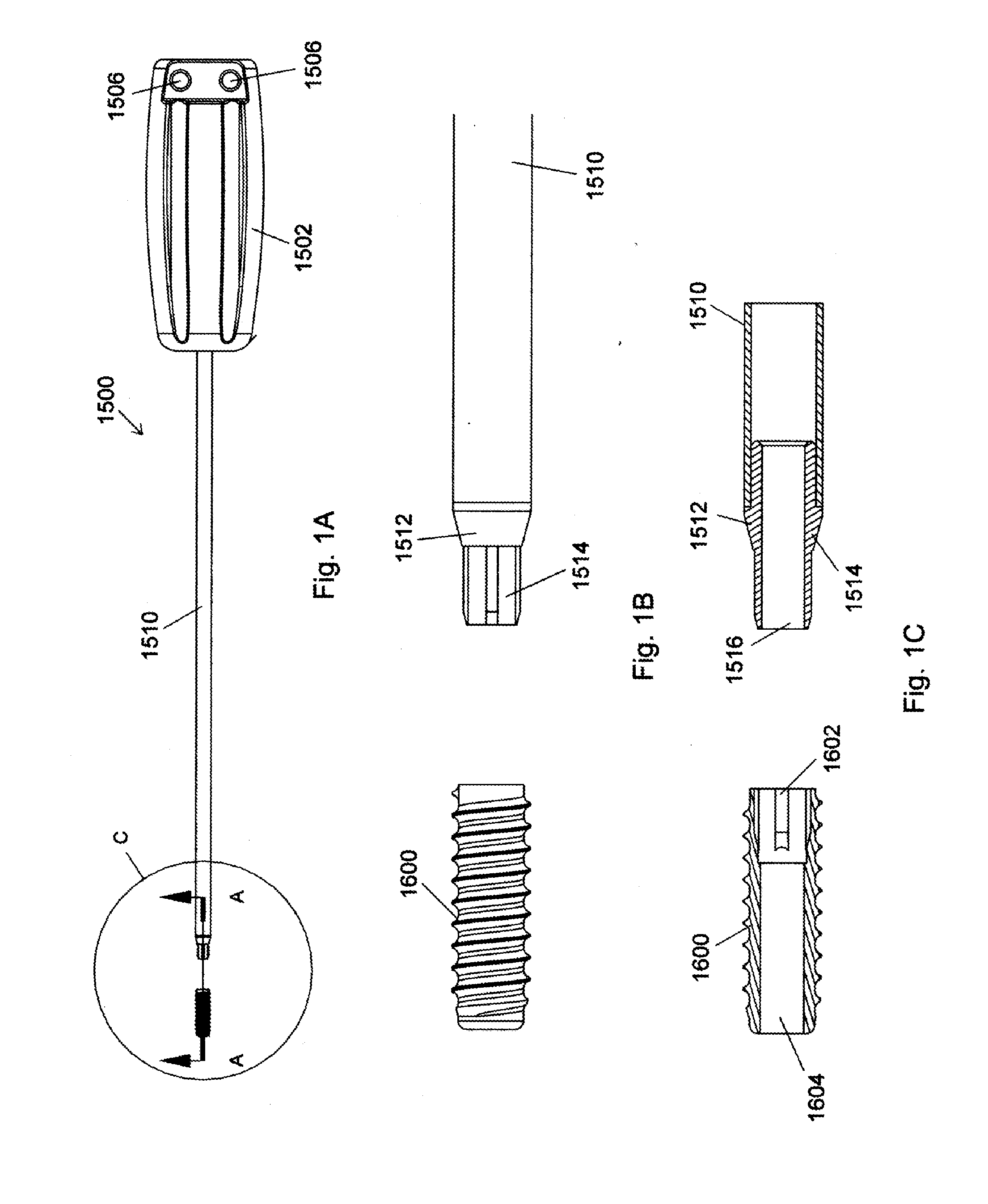 Implant placement systems, devices, and methods